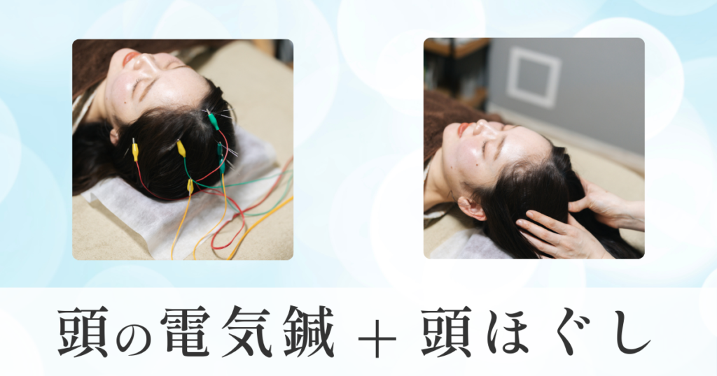 頭の電気鍼・頭ほぐし