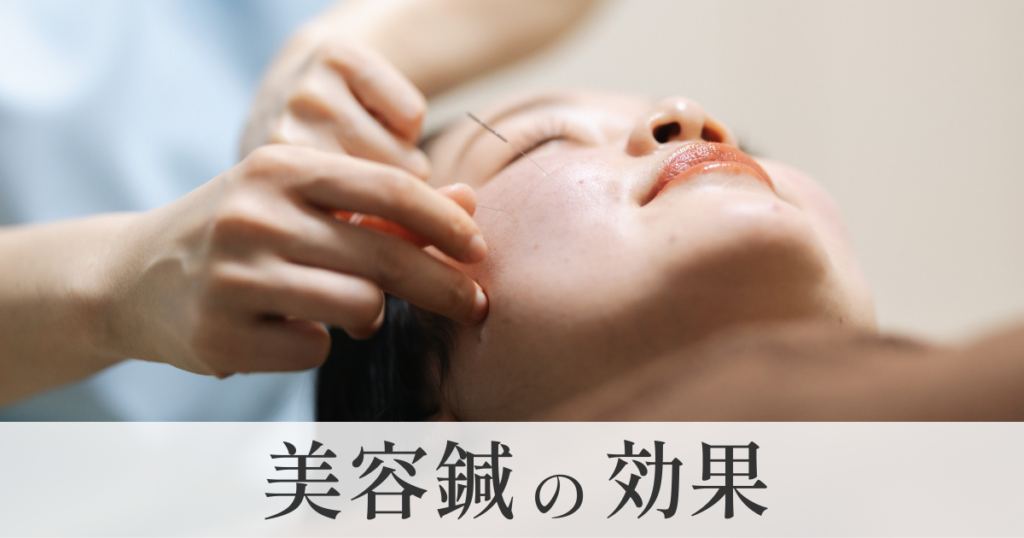 美容鍼の効果